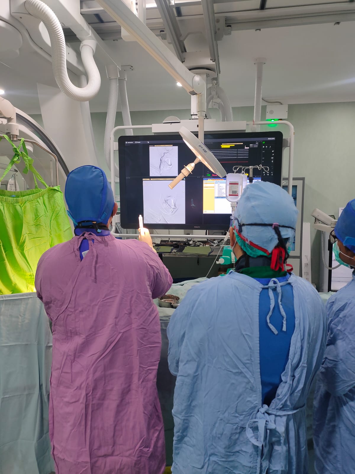 RSUD dr. Doris Sylvanus Hadirkan Teknologi Digital Subtraction Angiography